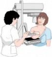 PROPONEN MAMOGRAFÍAS ANTES DE LOS 50 AÑOS, SI HAY RIESGO FAMILIAR 